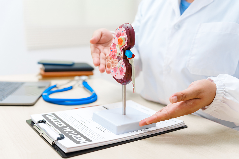 A doctor showcasing an anatomical diagram of a kidney
