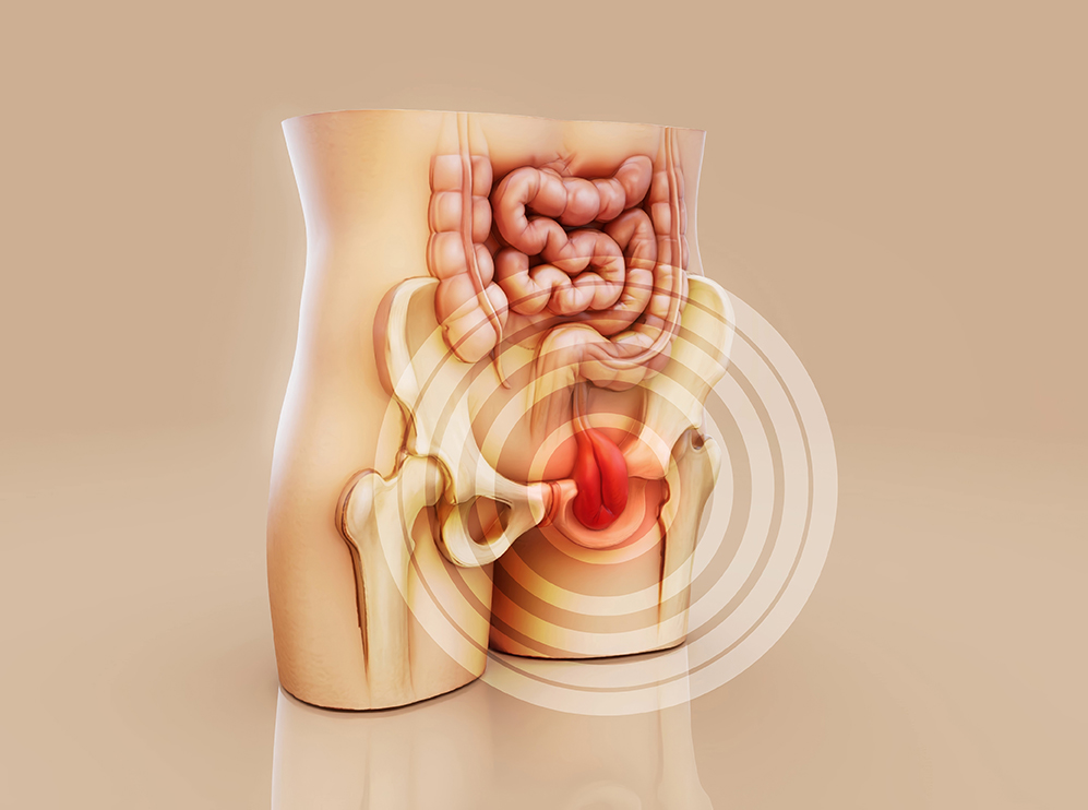 The location of a femoral hernia
