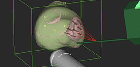 Specialised Urological Services - Accurate & Safe Prostate Cancer Diagnosis