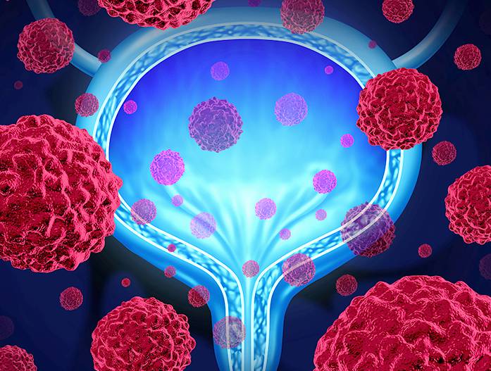 Testis Conditions, Treatment, & Procedures