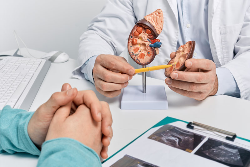 A doctor pointing to a model of a kidney with kidney stones